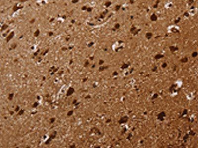 KARS Antibody