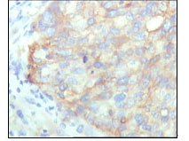 KARS Antibody