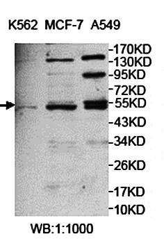 KATNAL1 Rabbit Polyclonal Antibody