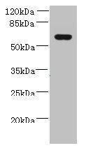 KATNAL2 Antibody