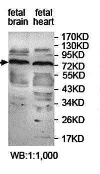 KATNB1 antibody