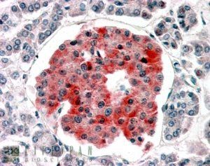 Goat anti-KCNJ11 / KATP / Antibody