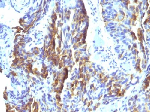 KBA.62 (Melanoma Associated Antigen) Antibody