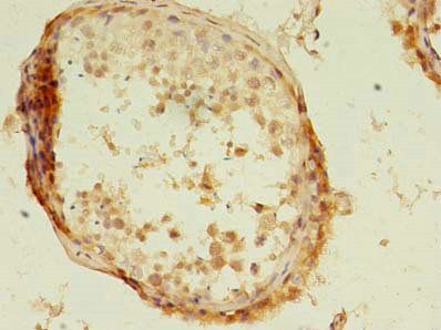 KBTBD4 Antibody
