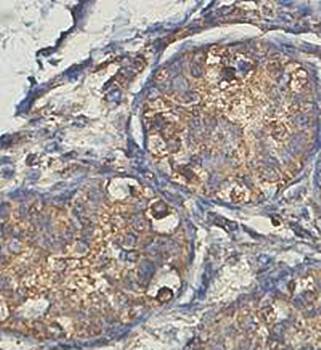 KBTBD4 Rabbit Polyclonal Antibody
