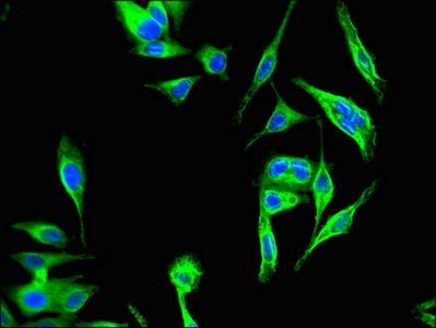 KBTBD6 Antibody