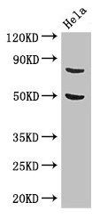 KBTBD6 Antibody