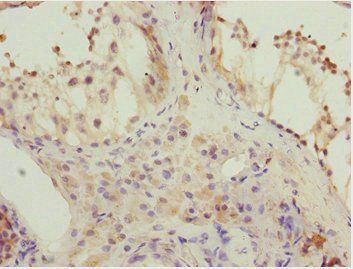 KBTBD7 Antibody