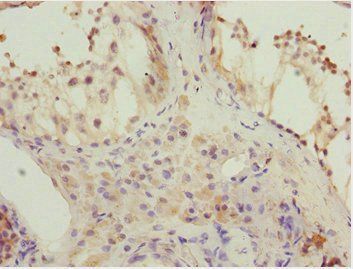 KBTBD7 antibody