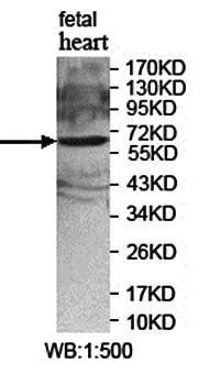 KBTBD7 Rabbit Polyclonal Antibody