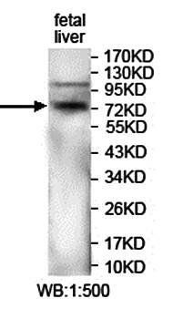 KBTBD8 Rabbit Polyclonal Antibody