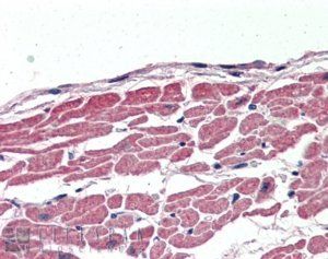 Goat anti-KCC3 / SLC12A6 Antibody