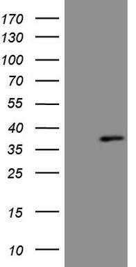 KChIP2 Antibody