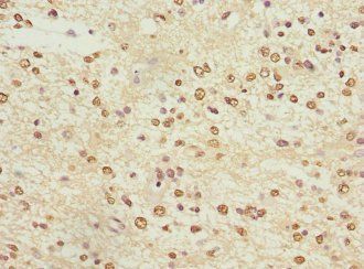 KCNA3 Antibody