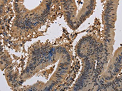 KCNA7 Antibody