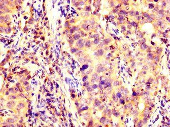 KCNAB1 Antibody