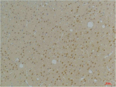 KCNAB1 Antibody