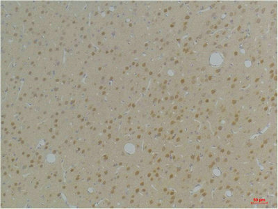 KCNAB1 antibody