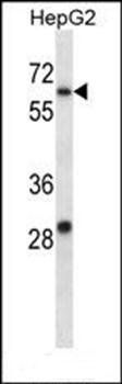 KCNC1 antibody