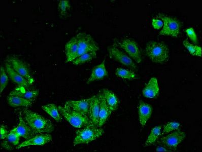 KCNC1 Antibody