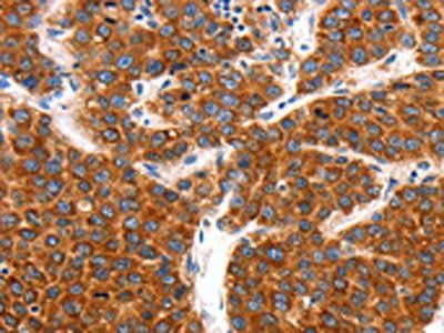 KCNC2 Antibody