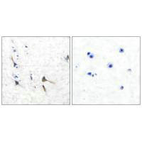 KCNC2 Antibody