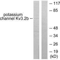 KCNC2 antibody