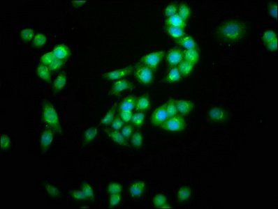 KCNC3 Antibody