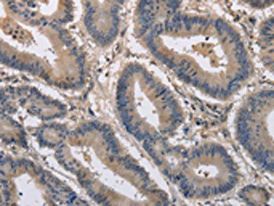 KCND1 Antibody