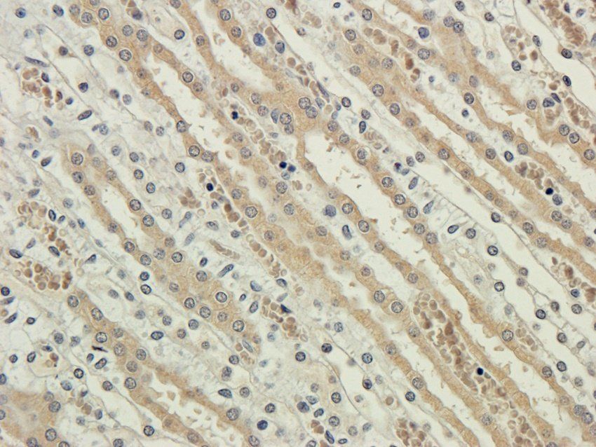 KCND3 antibody