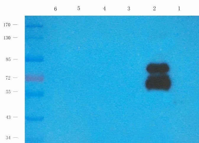 KCND3 antibody