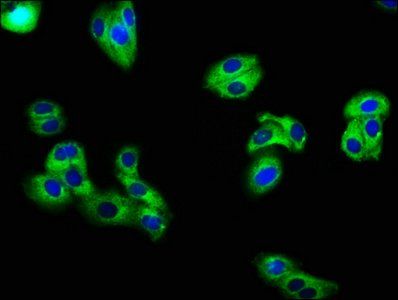 KCNE3 antibody