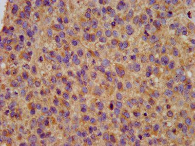 KCNE3 antibody