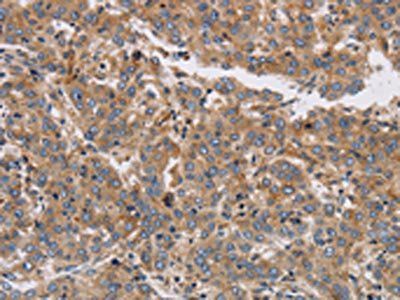 KCNG1 Antibody