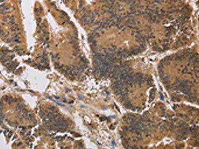 KCNG4 Antibody