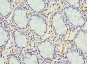 KCNH1 Antibody