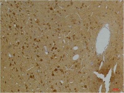 KCNH5 Antibody