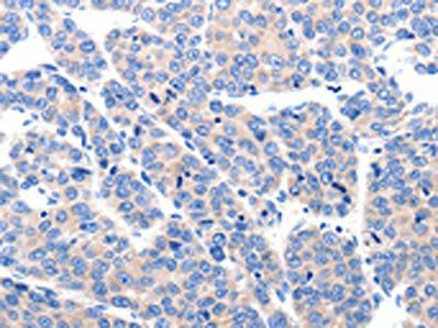 KCNH8 Antibody