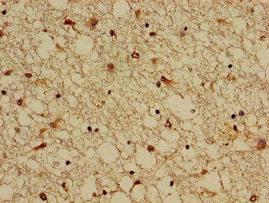 KCNIP3 Antibody