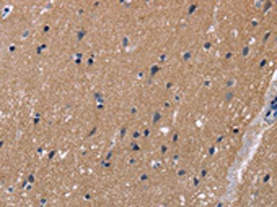 KCNJ11 Antibody