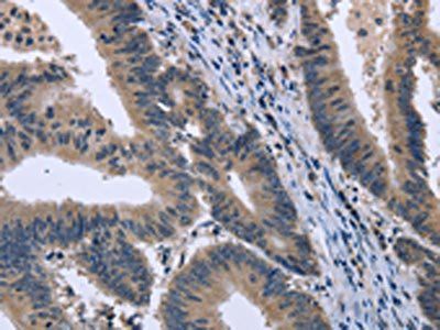 KCNJ11 Antibody