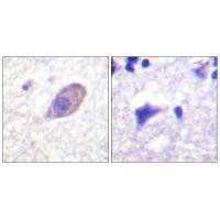 KCNJ16 (Ab-416) Antibody