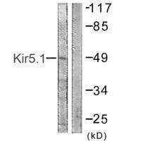 KCNJ16 (Ab-416) Antibody