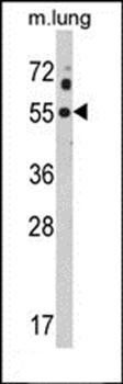 KCNJ2 antibody