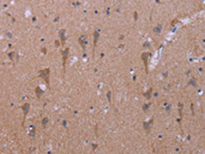 KCNJ9 Antibody