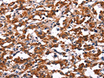 KCNJ9 Antibody