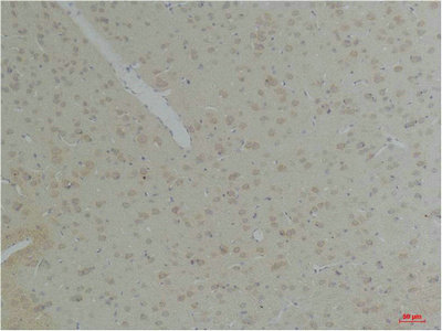 KCNK10 Antibody