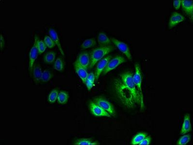KCNK13 Antibody
