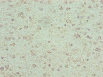 KCNK13 Antibody