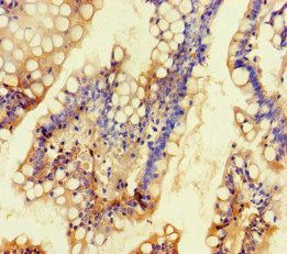 KCNK16 Antibody